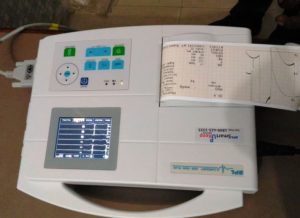 ECG
